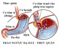 Bài thuốc trị bệnh trào ngược dạ dày thực quản